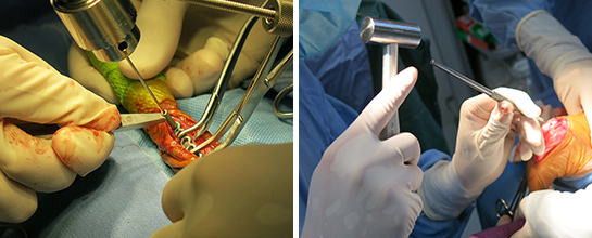 整形外科（各種骨折、膝蓋骨脱臼、レッグペルテス.etc）