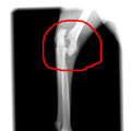 前肢の骨折（前腕骨遠位端）